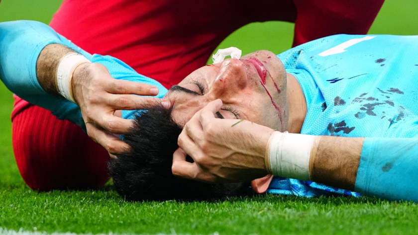 Alireza Beiranvand of Iran receives treatment for a bloodied nose
England v Iran, FIFA World Cup 2022, Group B, Football, Khalifa International Stadium, Ar-Rayyan, Qatar - 21 Nov 2022,Image: 739117468, License: Rights-managed, Restrictions: Editorial Use Only, Model Release: no